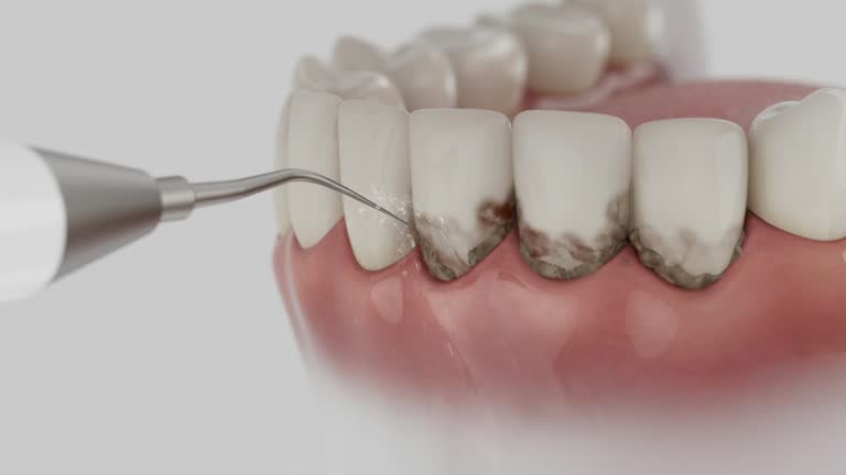 Reliable Tooth Extraction contractor in Rexburg, ID by Smile Center Dentistry